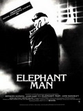 Elephant man